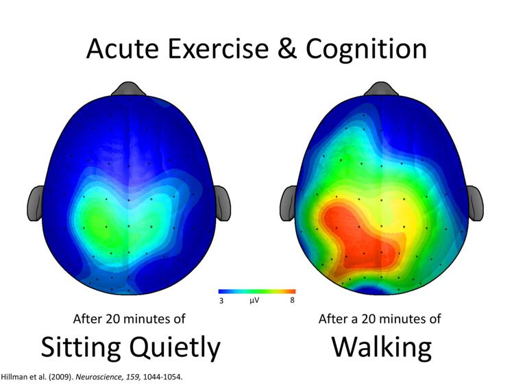 Brain activity comparison after sitting quietly versus walking